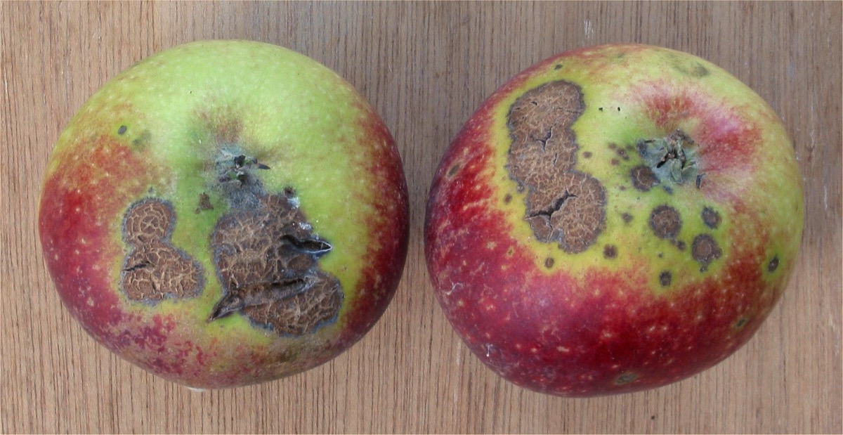 What disease is this?